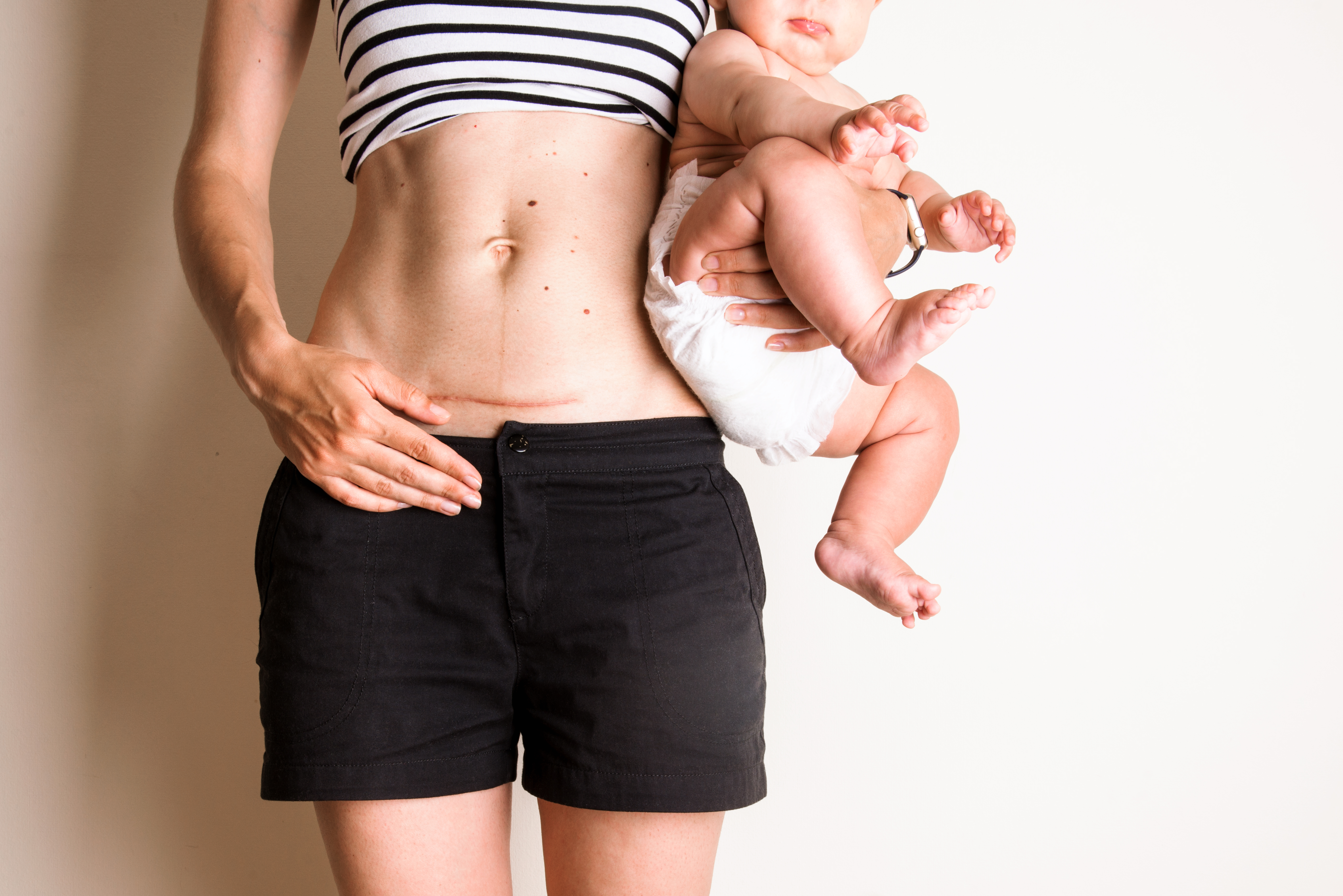 Postnatal care for mums